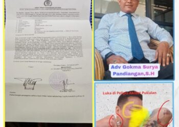(Kiri) Surat Tanda Penerimaan Laporan (STPL) resmi dari Polres Pematangsiantar terkait dugaan penganiayaan terhadap Mulianto. (Kanan Atas) Kuasa Hukum pelapor, Adv. Gokma Surya Partogi Pandiangan, S.H. (Kanan Bawah) Kondisi luka pada bagian pelipis korban akibat pemukulan yang dilakukan oleh terlapor inisial B.(Doc/Foto : Ist)