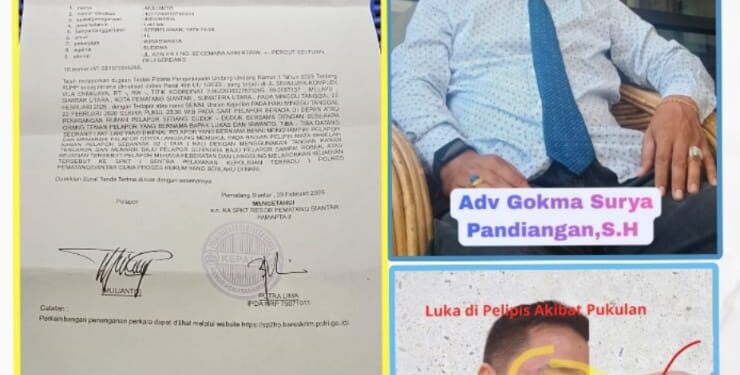 (Kiri) Surat Tanda Penerimaan Laporan (STPL) resmi dari Polres Pematangsiantar terkait dugaan penganiayaan terhadap Mulianto. (Kanan Atas) Kuasa Hukum pelapor, Adv. Gokma Surya Partogi Pandiangan, S.H. (Kanan Bawah) Kondisi luka pada bagian pelipis korban akibat pemukulan yang dilakukan oleh terlapor inisial B.(Doc/Foto : Ist)
